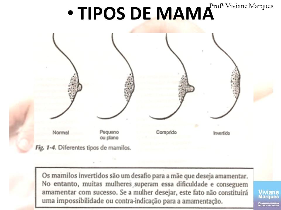 TIPOS DE MAMA Profª Viviane Marques