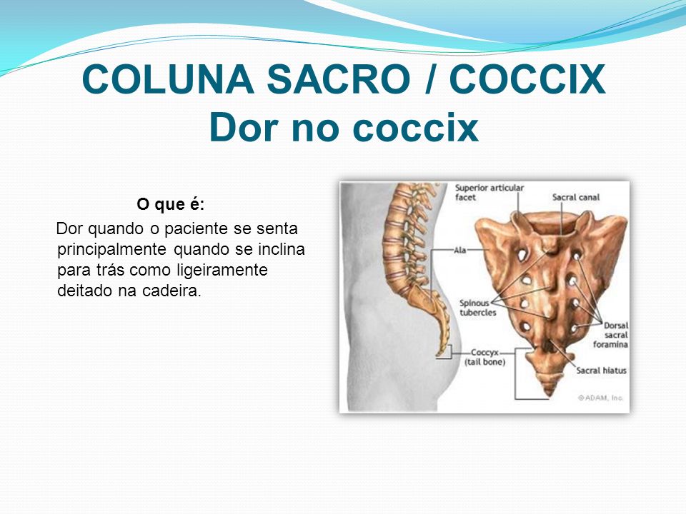 COLUNA SACRO / COCCIX Dor no coccix