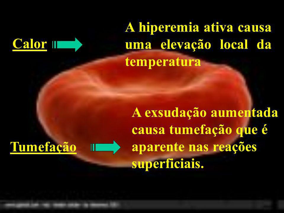 A hiperemia ativa causa uma elevação local da temperatura