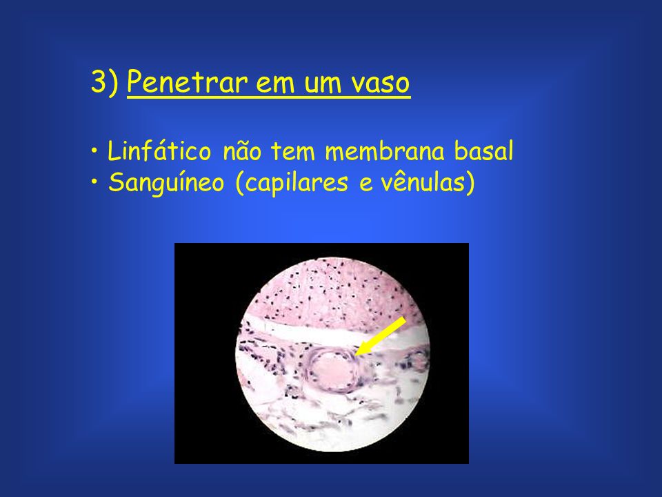 3) Penetrar em um vaso Linfático não tem membrana basal