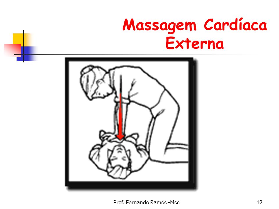 Massagem Cardíaca Externa