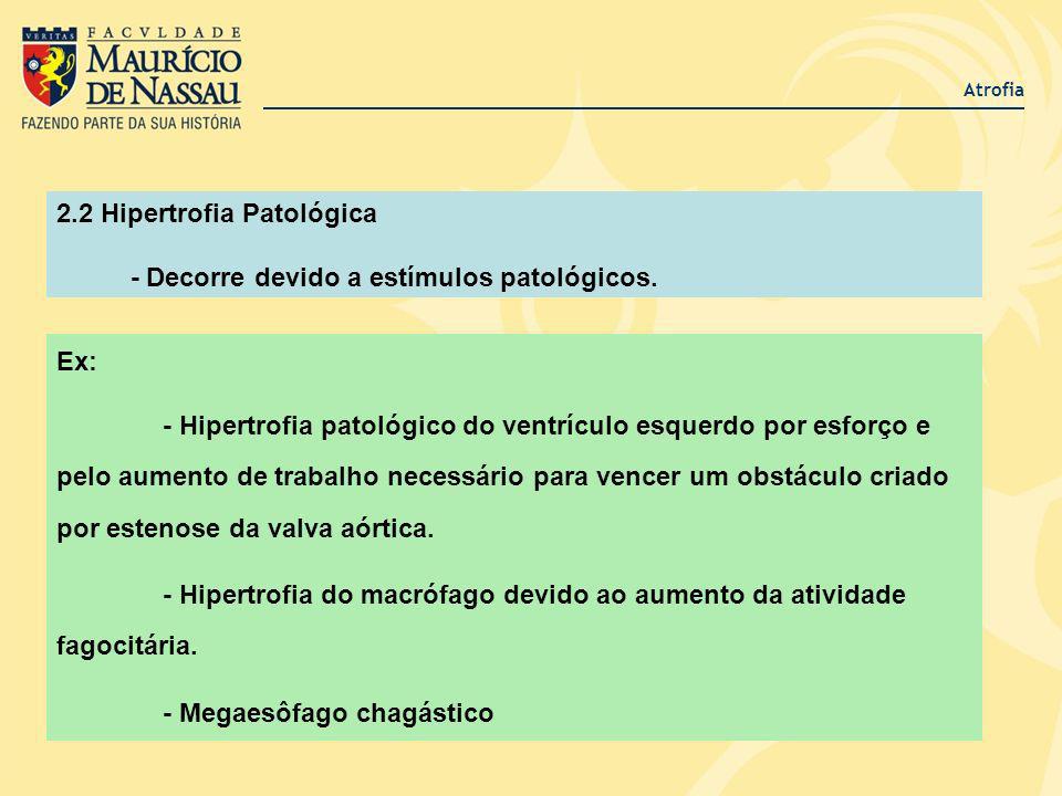 2.2 Hipertrofia Patológica - Decorre devido a estímulos patológicos.