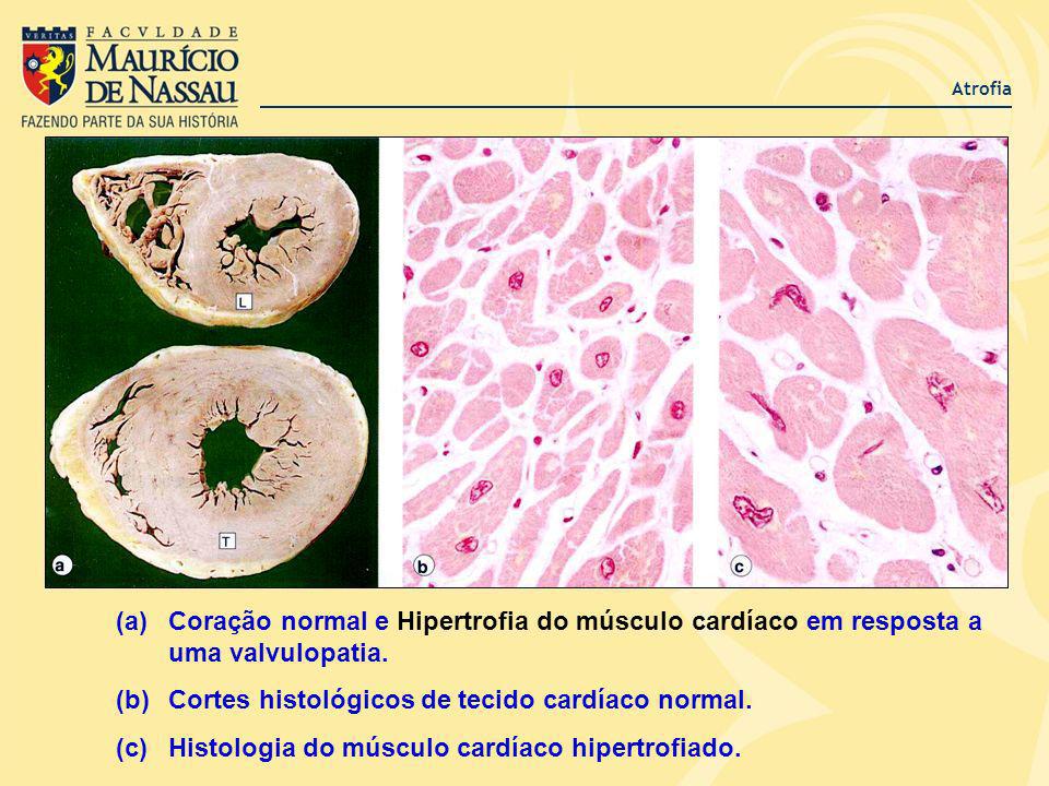 Cortes histológicos de tecido cardíaco normal.