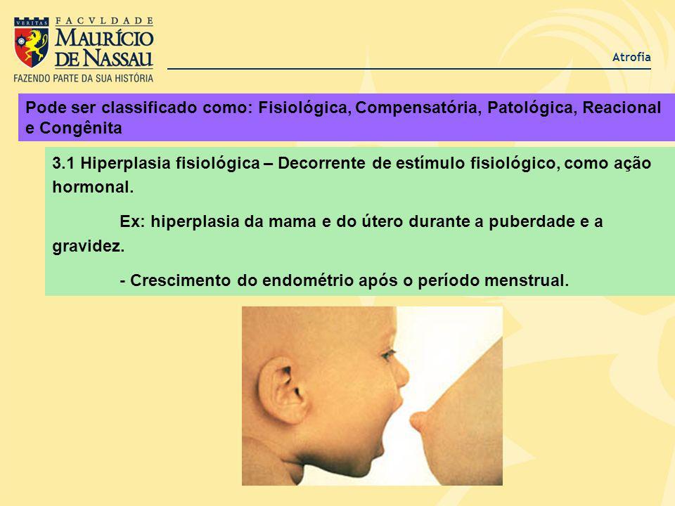 Ex: hiperplasia da mama e do útero durante a puberdade e a gravidez.