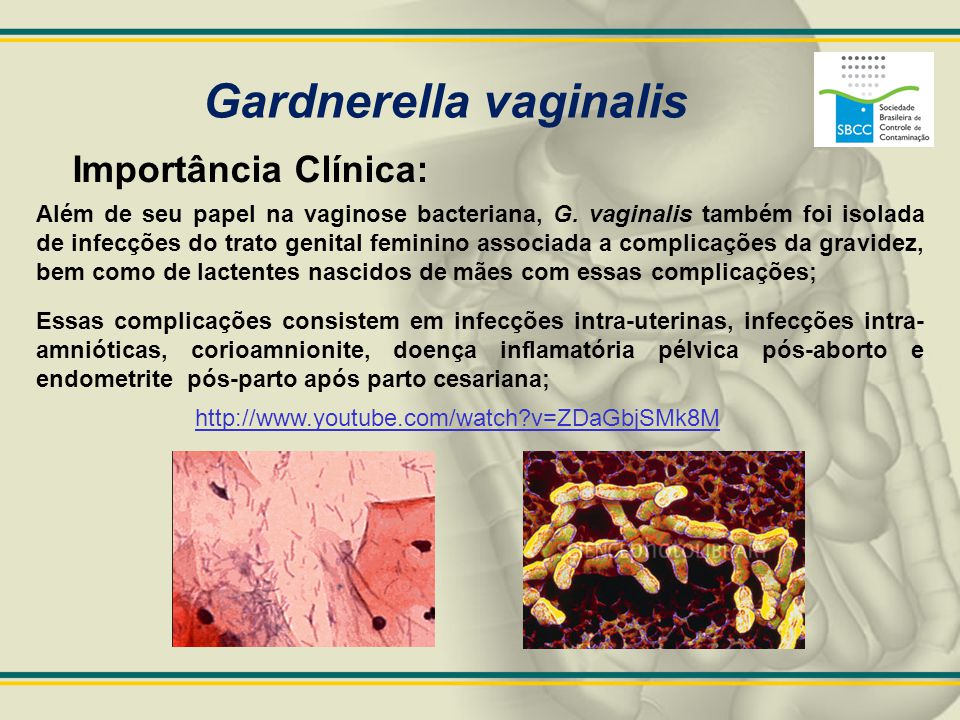 Gardnerella vaginalis.