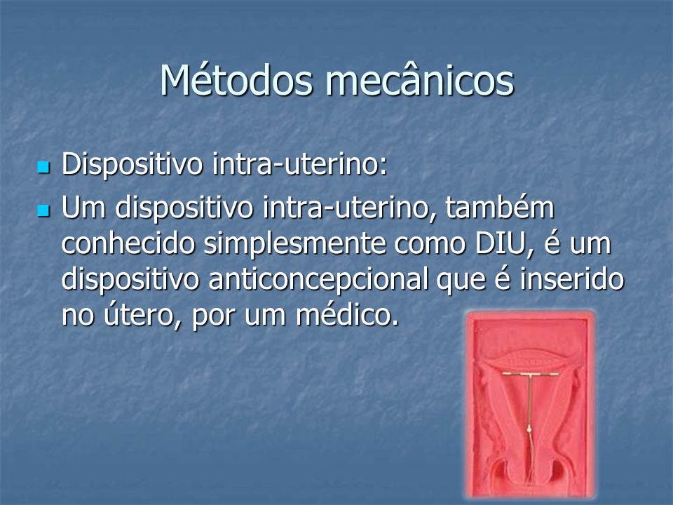 Métodos mecânicos Dispositivo intra-uterino: