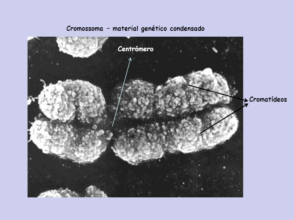 Cromossoma – material genético condensado
