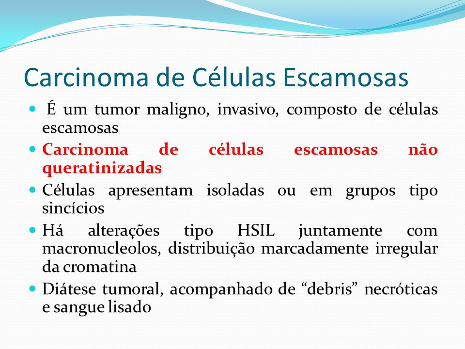 Carcinoma de Células Escamosas