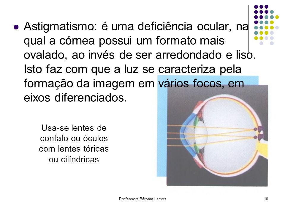 Miopia: quando o globo ocular é longo e a imagem se forma de antes da retina.