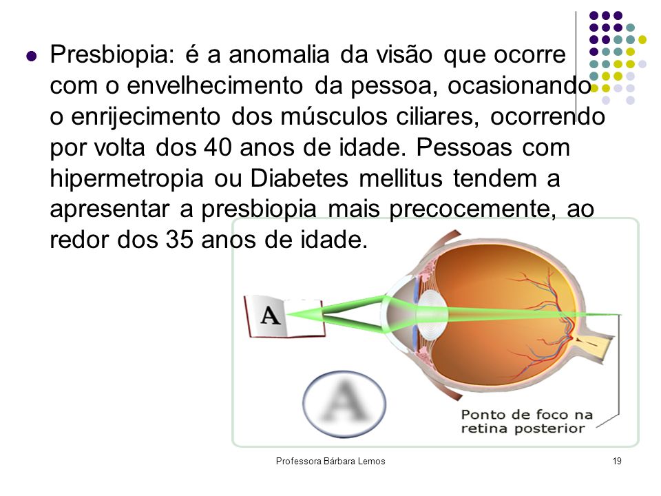 Astigmatismo: é uma deficiência ocular, na qual a córnea possui um formato mais ovalado, ao invés de ser arredondado e liso. Isto faz com que a luz se caracteriza pela formação da imagem em vários focos, em eixos diferenciados.