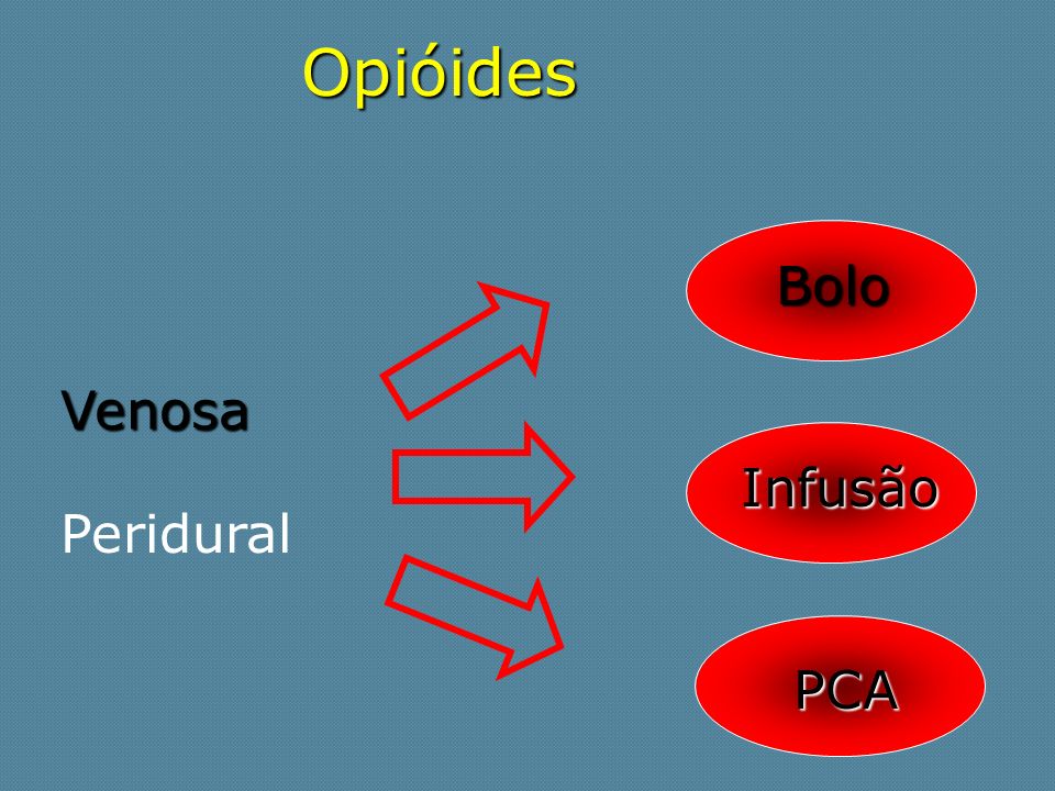 Opióides Bolo Venosa Infusão Peridural PCA