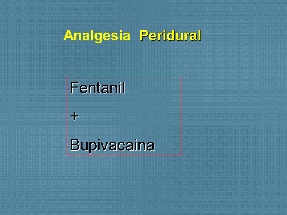 Analgesia Peridural Fentanil + Bupivacaina