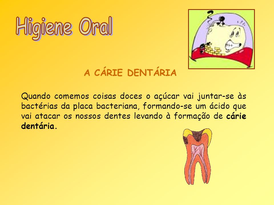 Higiene Oral A CÁRIE DENTÁRIA