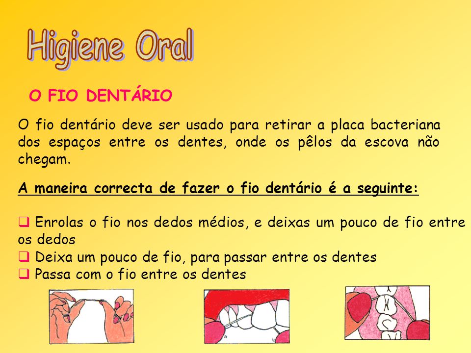 Higiene Oral O FIO DENTÁRIO