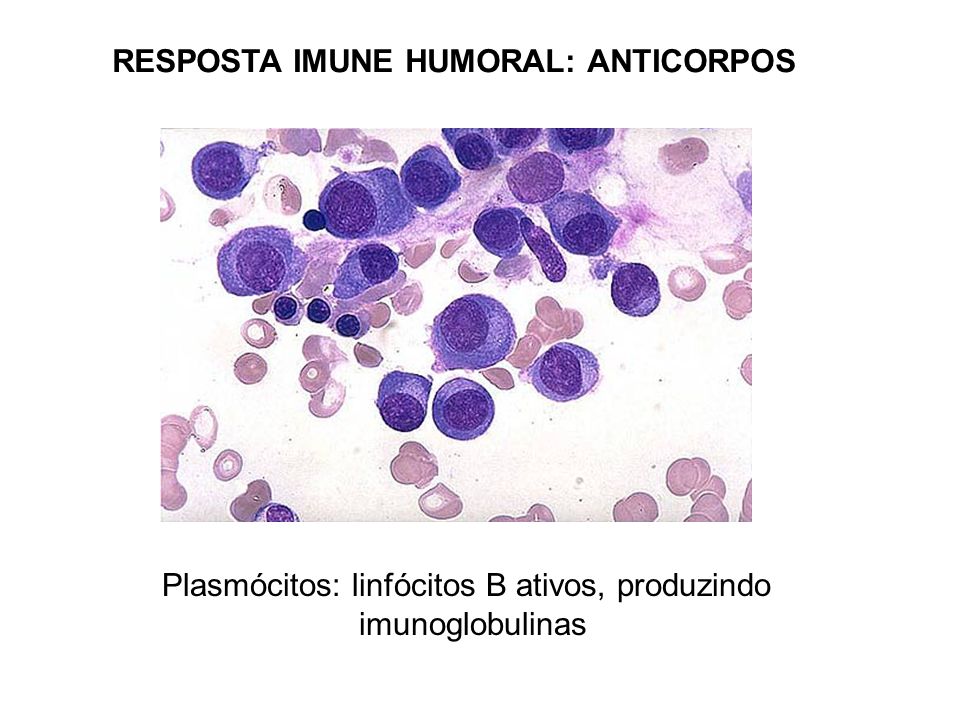 Plasmócitos: linfócitos B ativos, produzindo