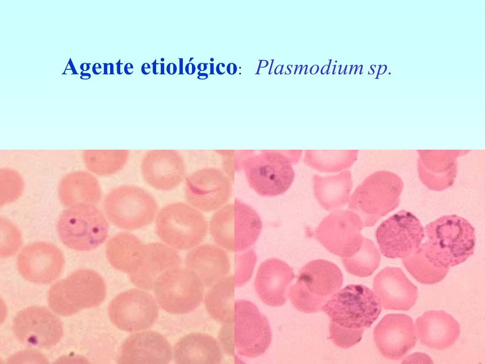 Agente etiológico: Plasmodium sp.