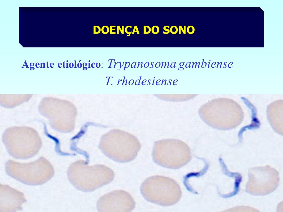 DOENÇA DO SONO Agente etiológico: Trypanosoma gambiense T. rhodesiense