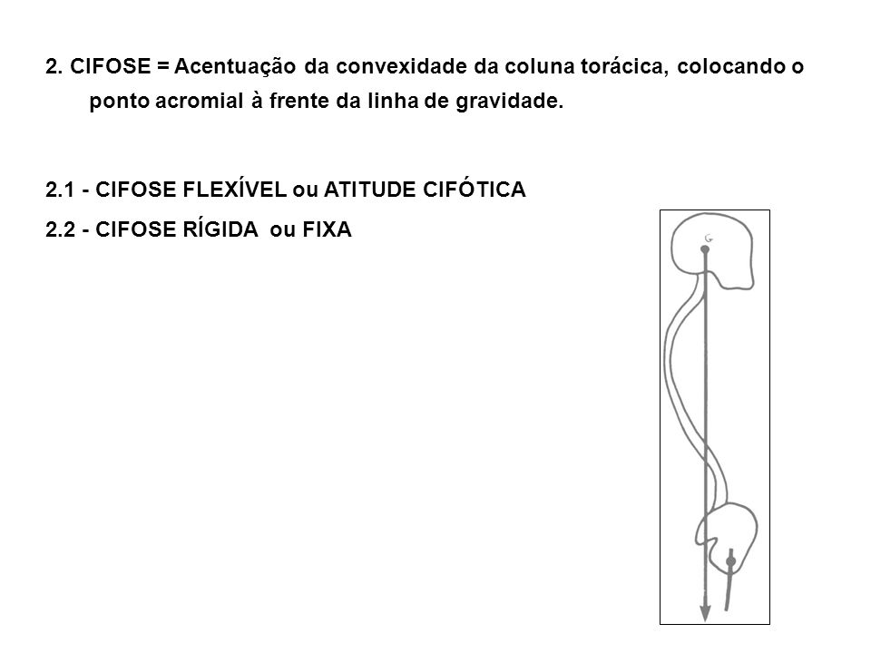 2. CIFOSE = Acentuação da convexidade da coluna torácica, colocando o ponto acromial à frente da linha de gravidade.