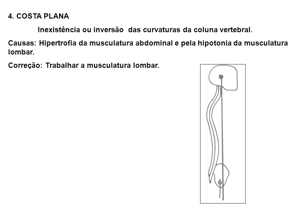 4. COSTA PLANA Inexistência ou inversão das curvaturas da coluna vertebral.