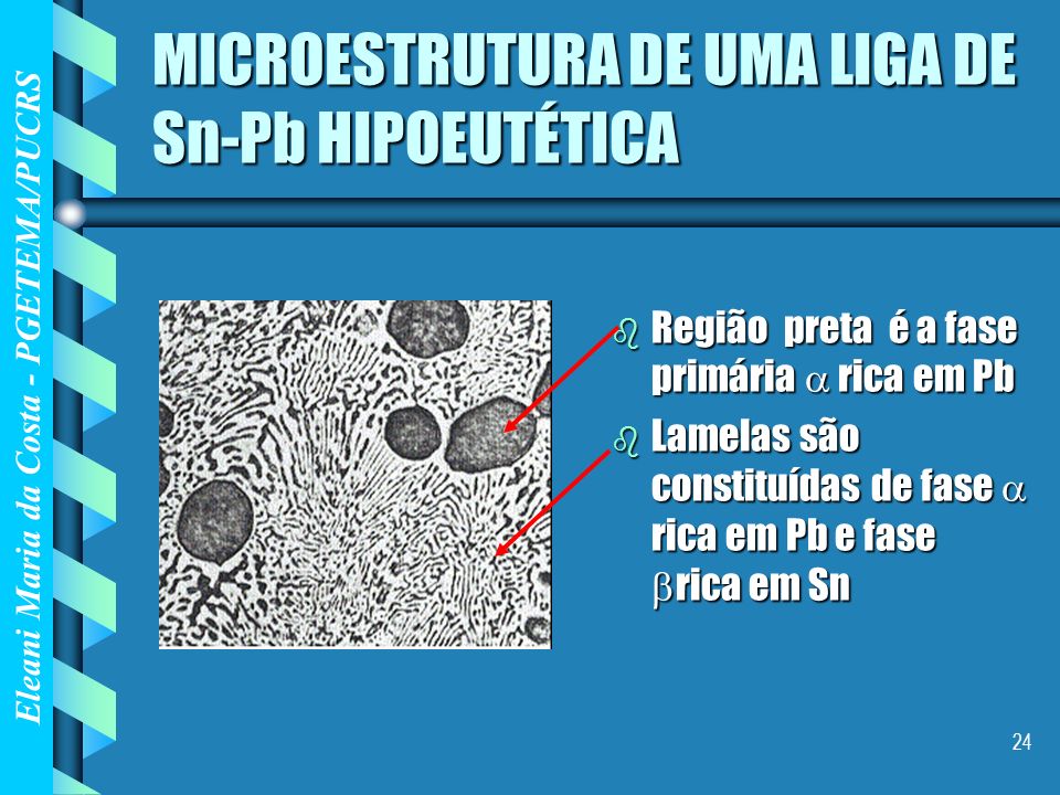 MICROESTRUTURA DE UMA LIGA DE Sn-Pb HIPOEUTÉTICA