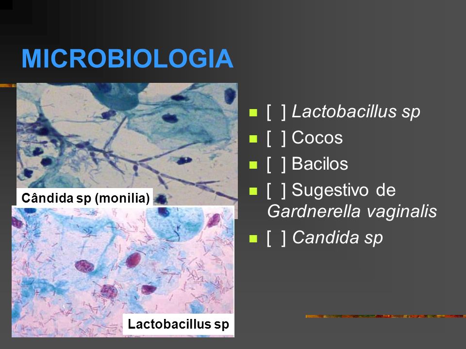 MICROBIOLOGIA [ ] Lactobacillus sp [ ] Cocos [ ] Bacilos