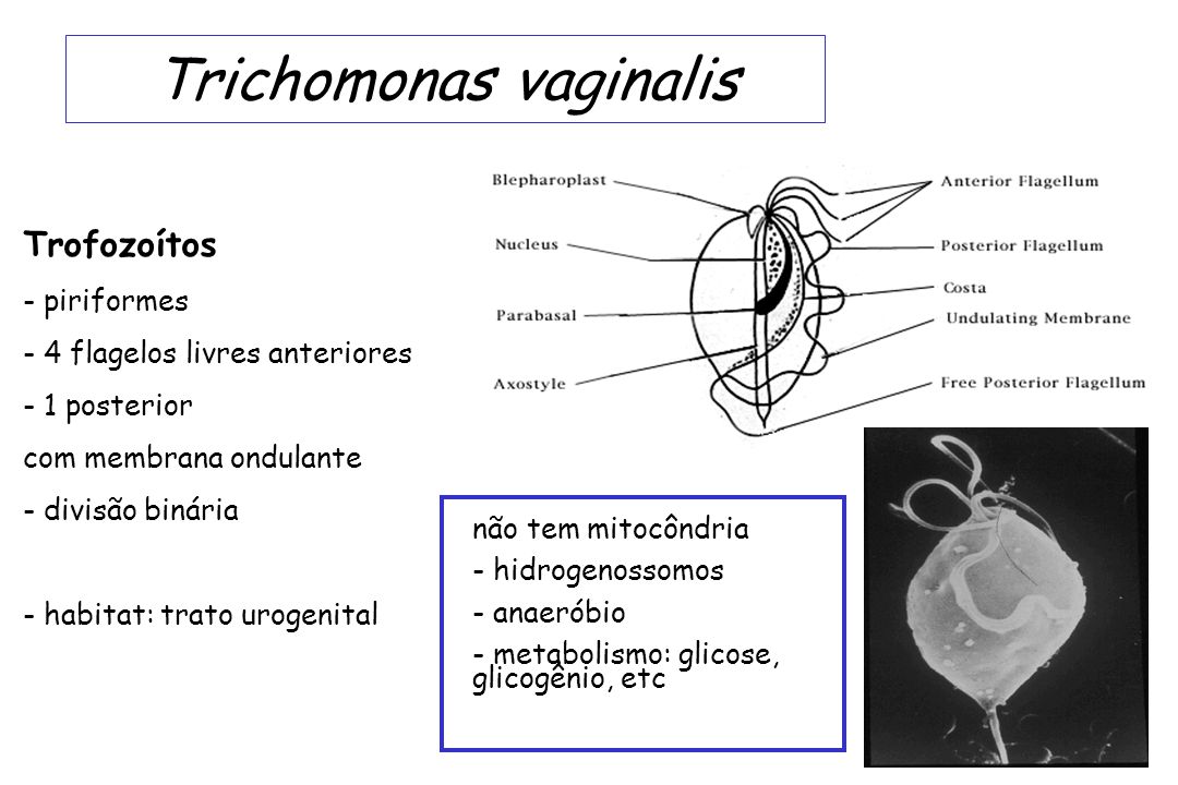 aki a Trichomonas vaginalis