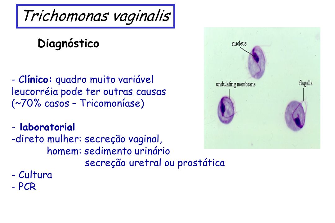 vetés a Trichomonas vaginalis ra