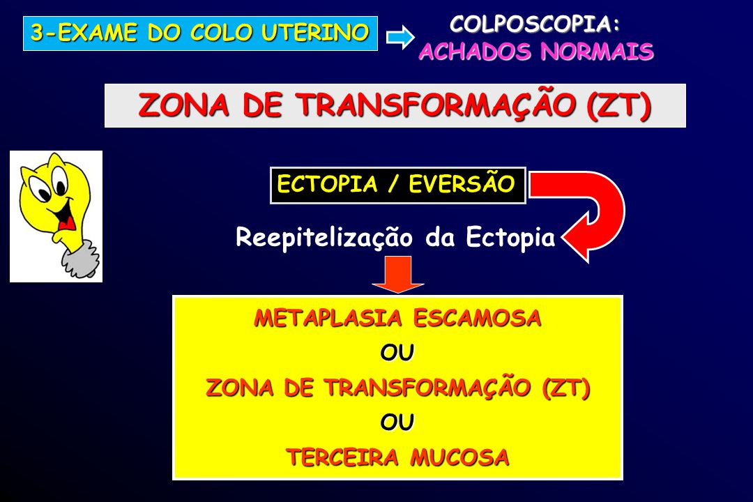 ZONA DE TRANSFORMAÇÃO (ZT)
