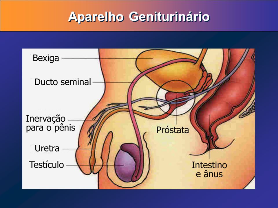 Hiperplazie acinară mică a prostatei ,diferențe de adenom de prostatită