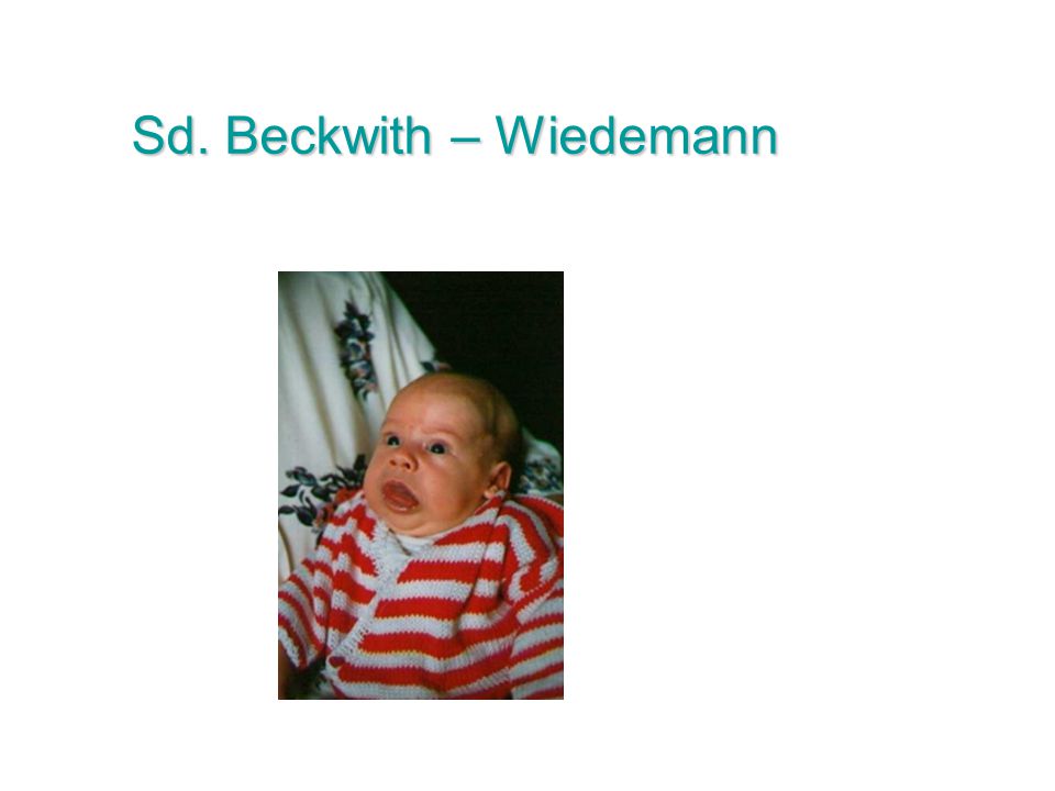 Sd. Beckwith – Wiedemann