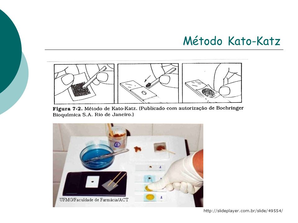 Método Kato-Katz