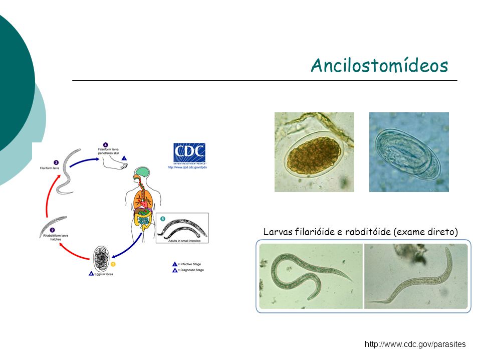 Ancilostomídeos Larvas filarióide e rabditóide (exame direto)