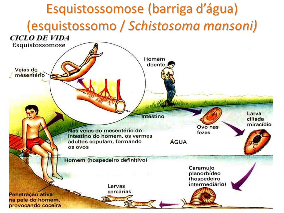 Esquistossomose (barriga d’água) (esquistossomo / Schistosoma mansoni)