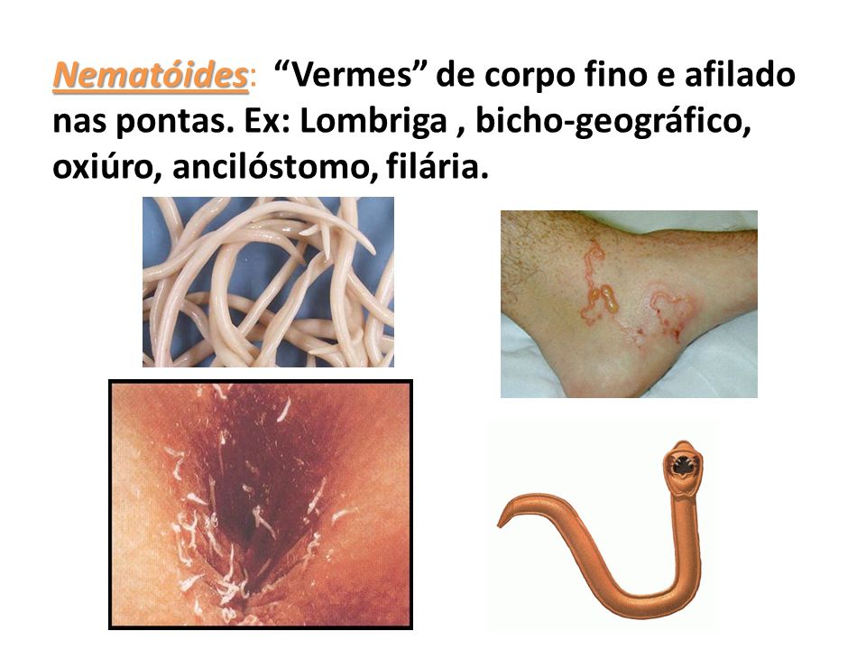 Nematóides: Vermes de corpo fino e afilado nas pontas