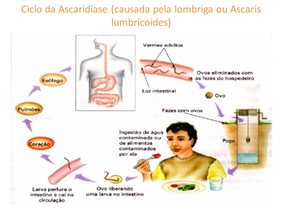 Ciclo da Ascaridíase (causada pela lombriga ou Ascaris lumbricoides)