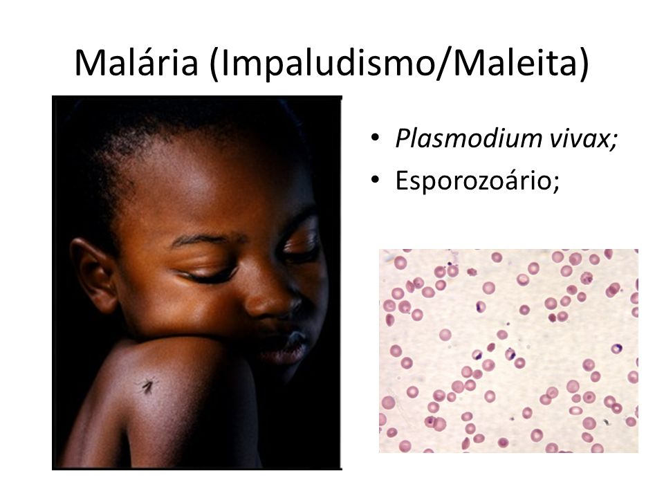 Malária (Impaludismo/Maleita)
