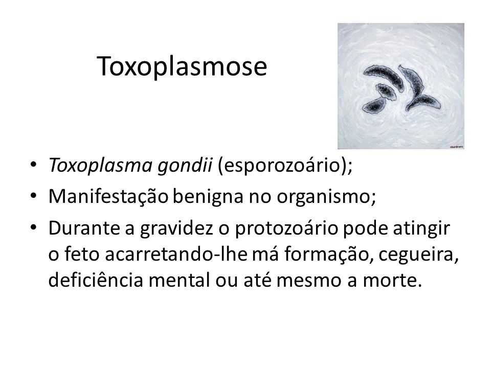 Toxoplasmose Toxoplasma gondii (esporozoário);