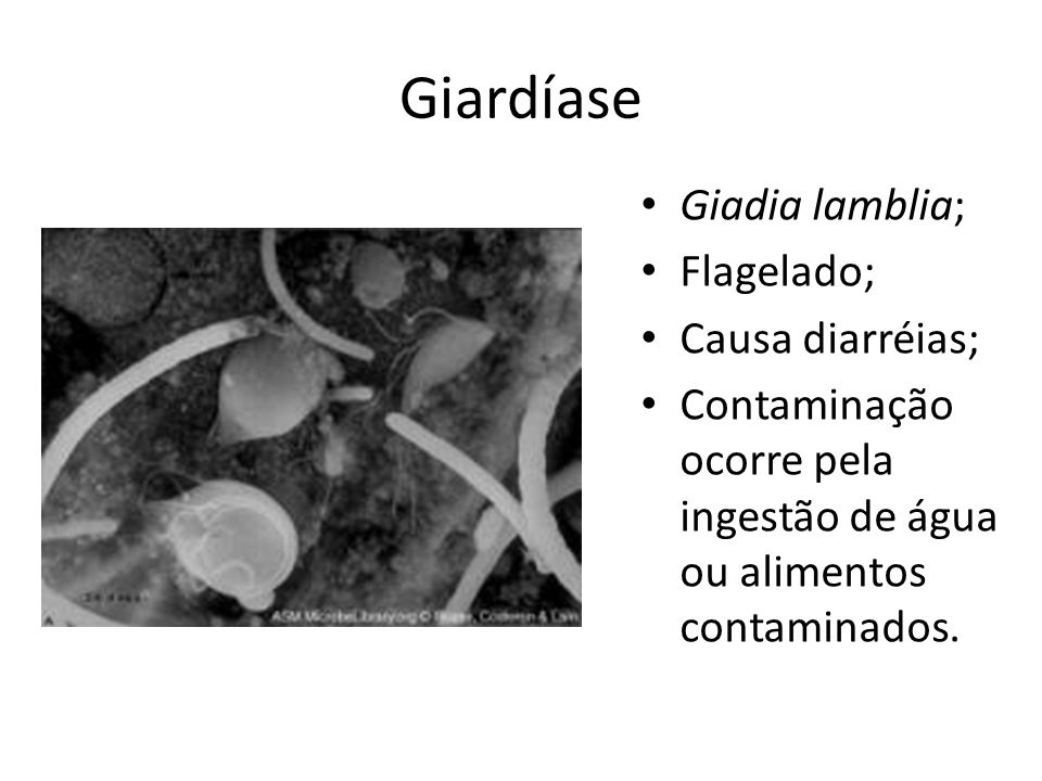 Giardíase Giadia lamblia; Flagelado; Causa diarréias;