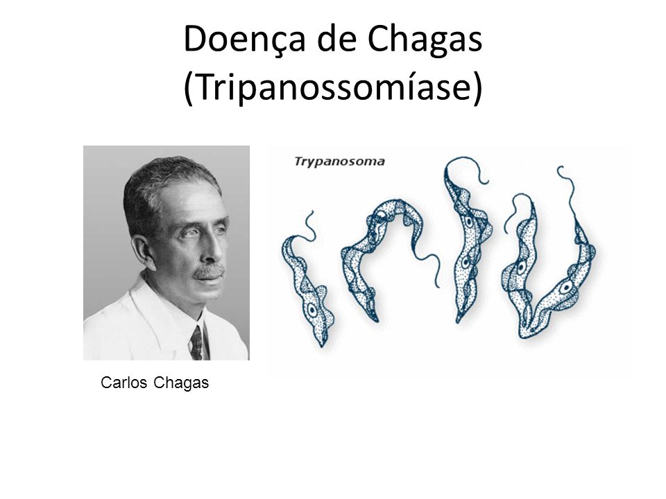 Doença de Chagas (Tripanossomíase)