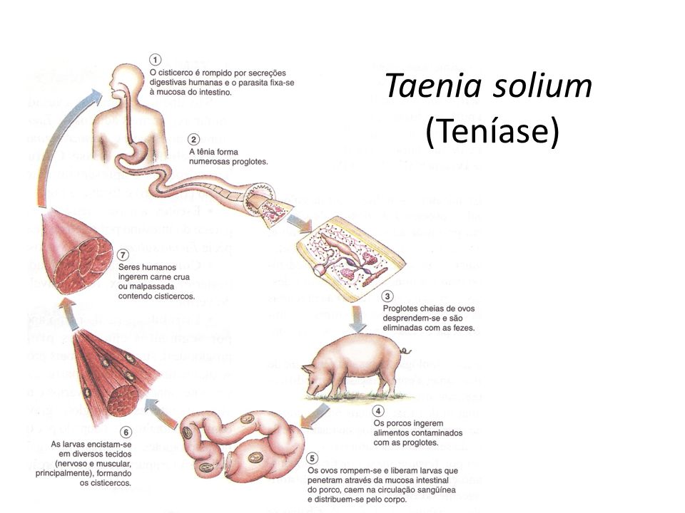 Taenia solium (Teníase)