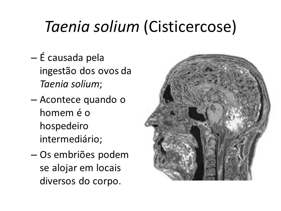 Taenia solium (Cisticercose)
