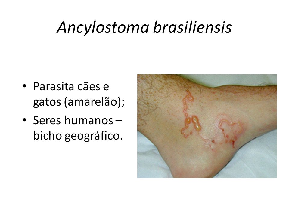 Ancylostoma brasiliensis