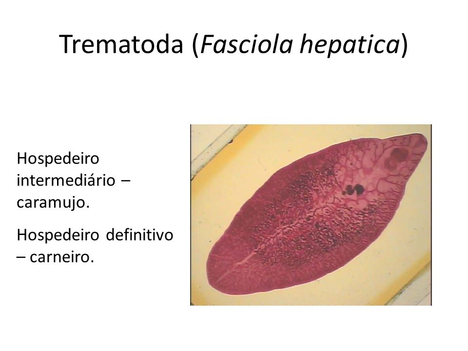 Trematoda (Fasciola hepatica)