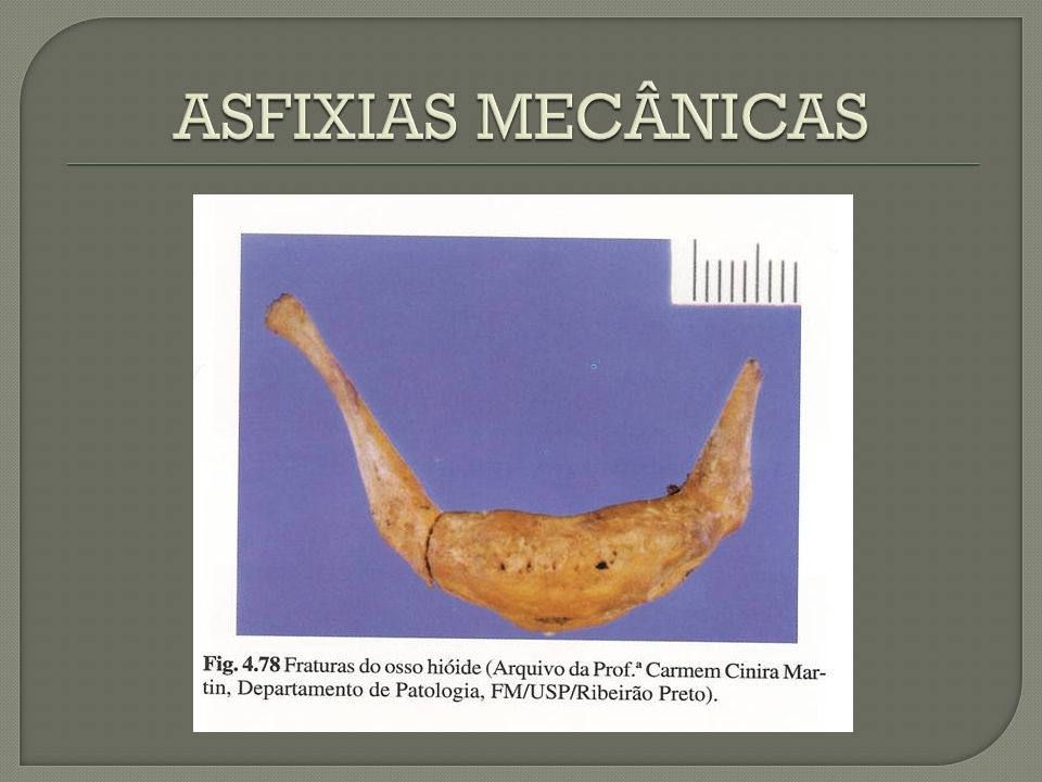 ASFIXIAS MECÂNICAS