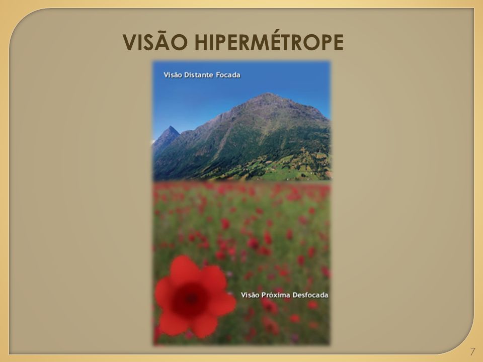 VISÃO HIPERMÉTROPE