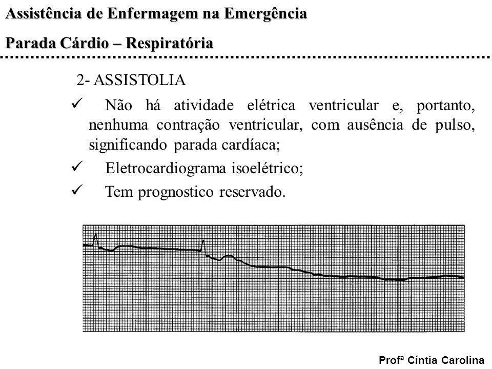 2- ASSISTOLIA Não há atividade elétrica ventricular e, portanto, nenhuma contração ventricular, com ausência de pulso, significando parada cardíaca;
