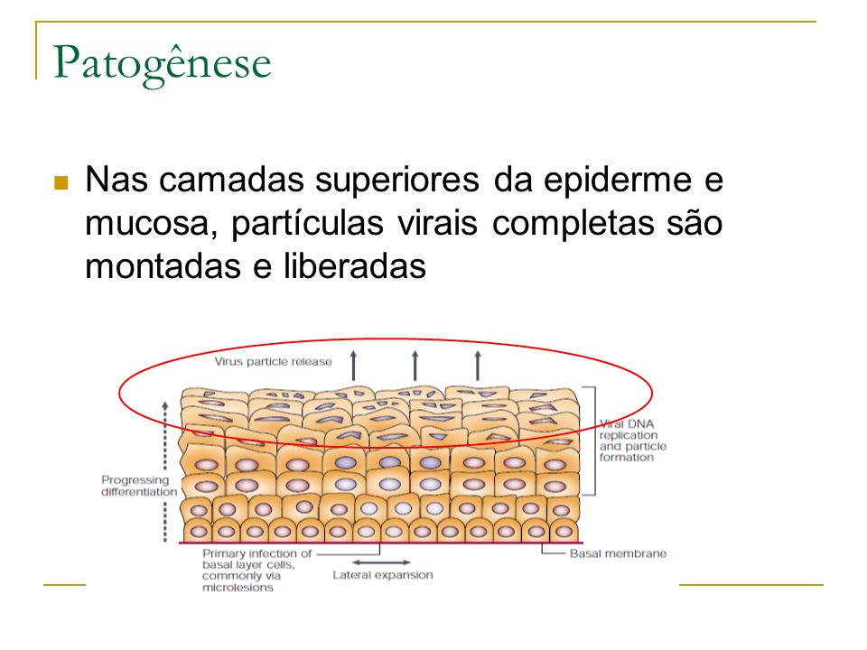 Patogênese Nas camadas superiores da epiderme e mucosa, partículas virais completas são montadas e liberadas.