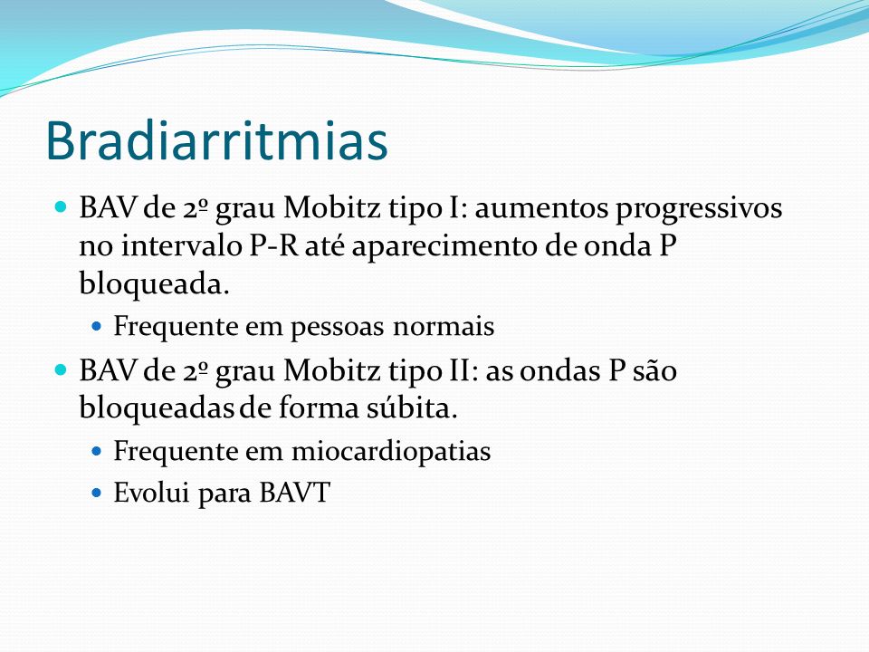 Bradiarritmias BAV de 2º grau Mobitz tipo I: aumentos progressivos no intervalo P-R até aparecimento de onda P bloqueada.