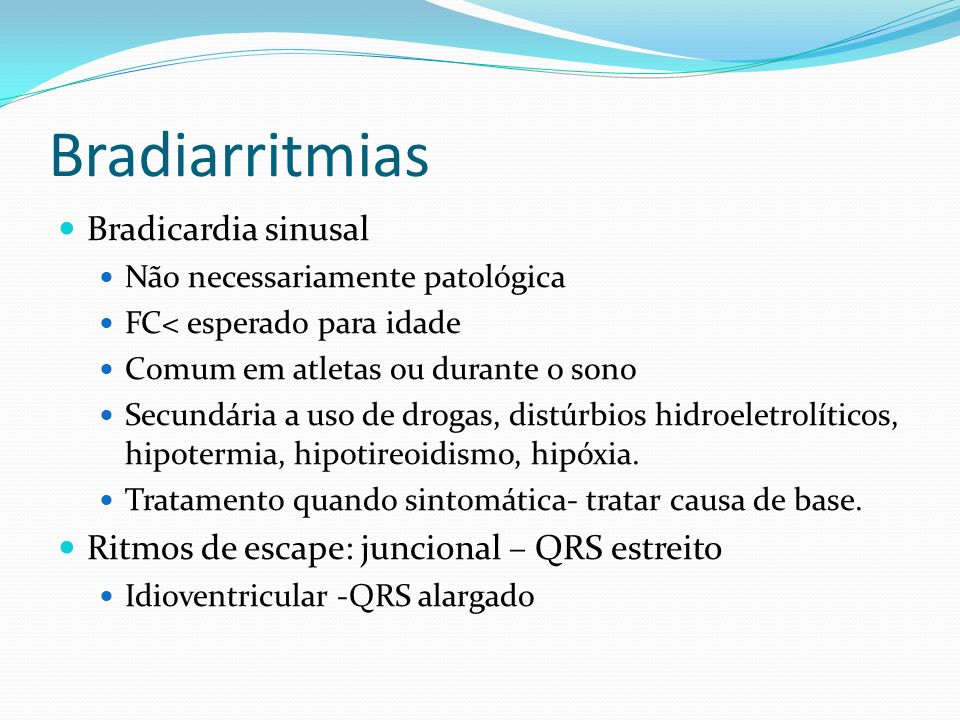 Bradiarritmias Bradicardia sinusal
