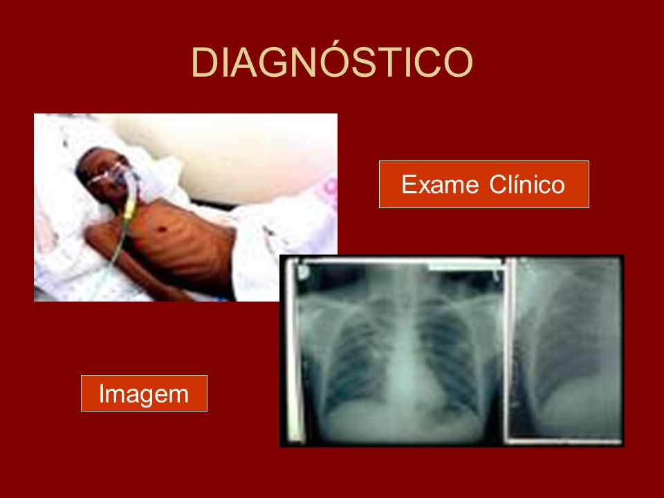 DIAGNÓSTICO Exame Clínico Imagem
